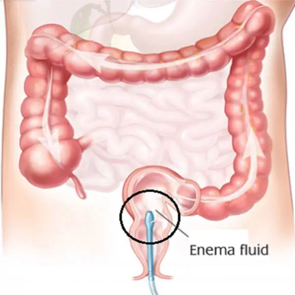 RS Physio & Aarogya Hospital